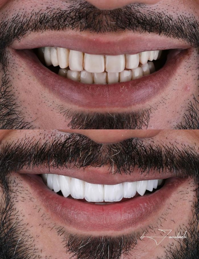 Dr Zainab doing cosmetic dental treatment