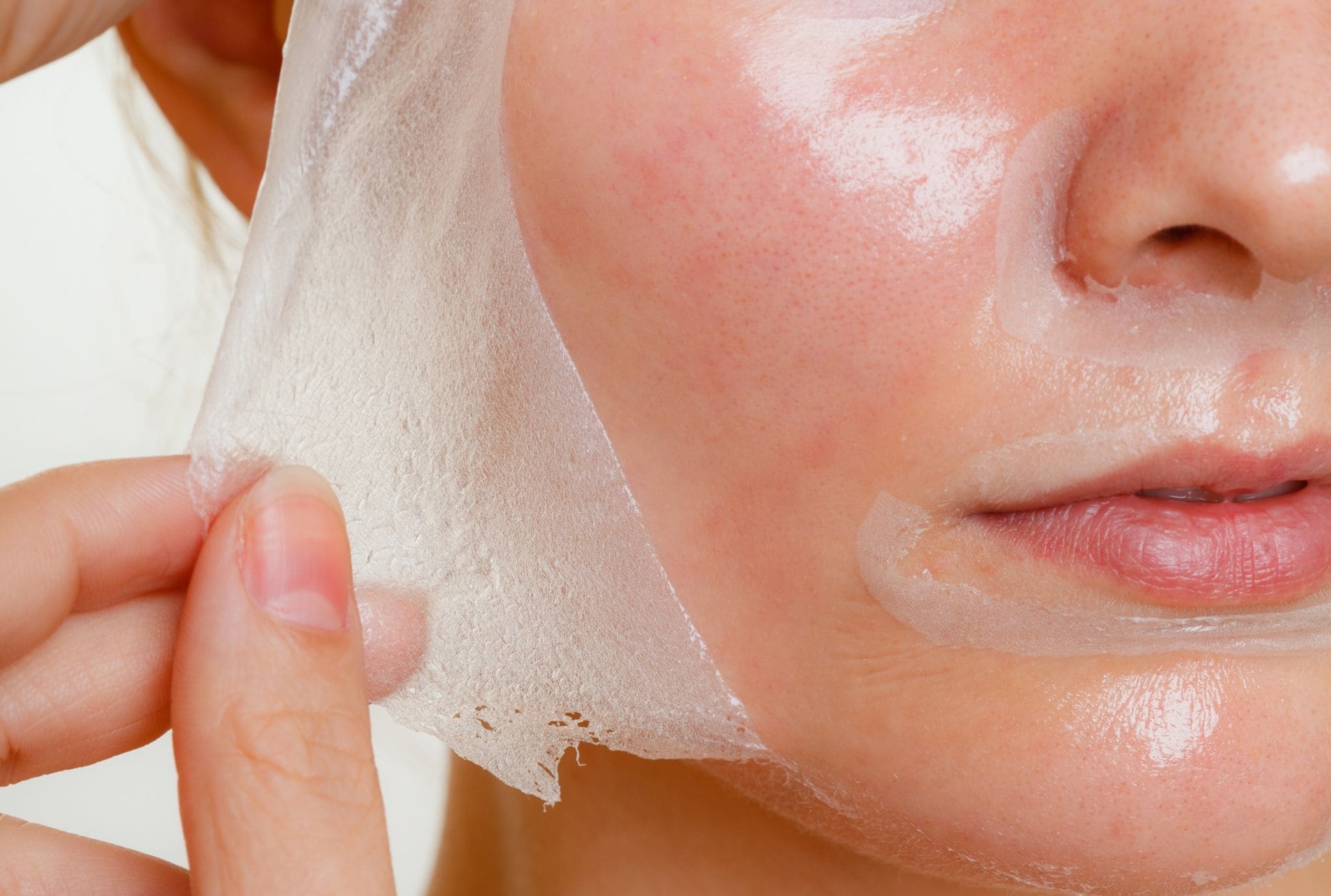 chemical peel